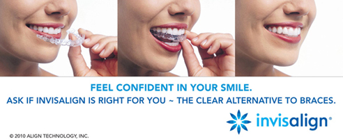 Invisalign Banner