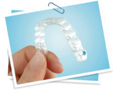 invisalign_2